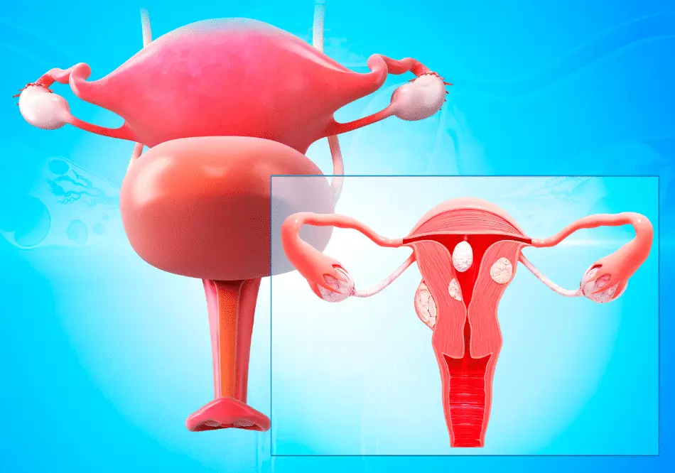 Bladder Cancer treatment in Ayurveda | Arogyavedh Ayurveda | Dr. Banashree Patil Baner Balewadi