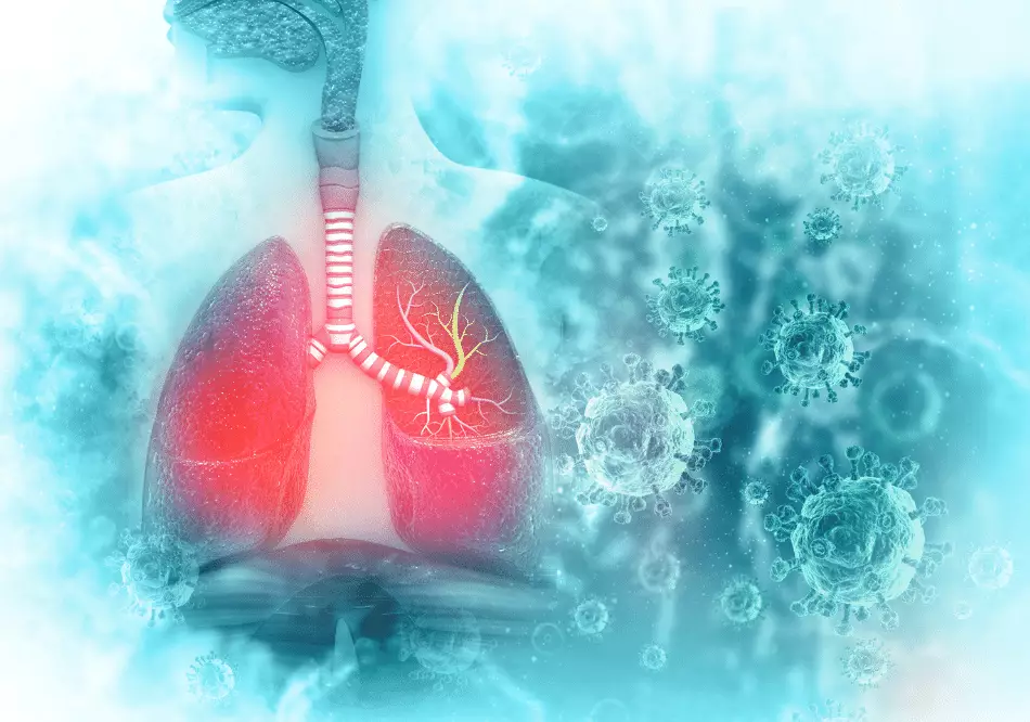 Lung Cancer_ treatment in Ayurveda Arogyavedh Ayurveda and Dr. Banashree Patil Baner Balewadi
