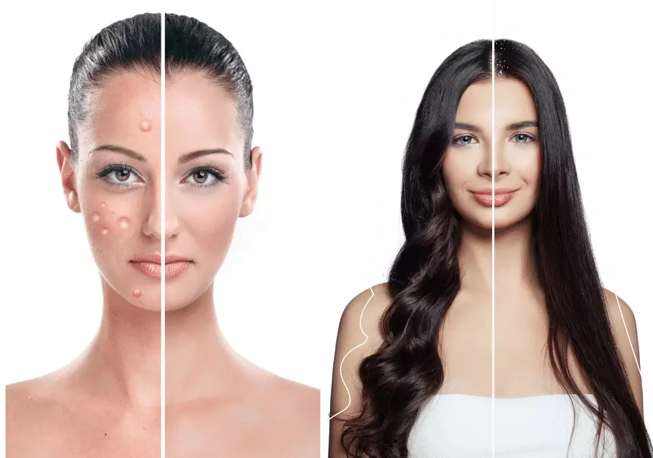 Skin Disease, Hair, and Beauty Treatment in Ayurveda – Baner Balewadi