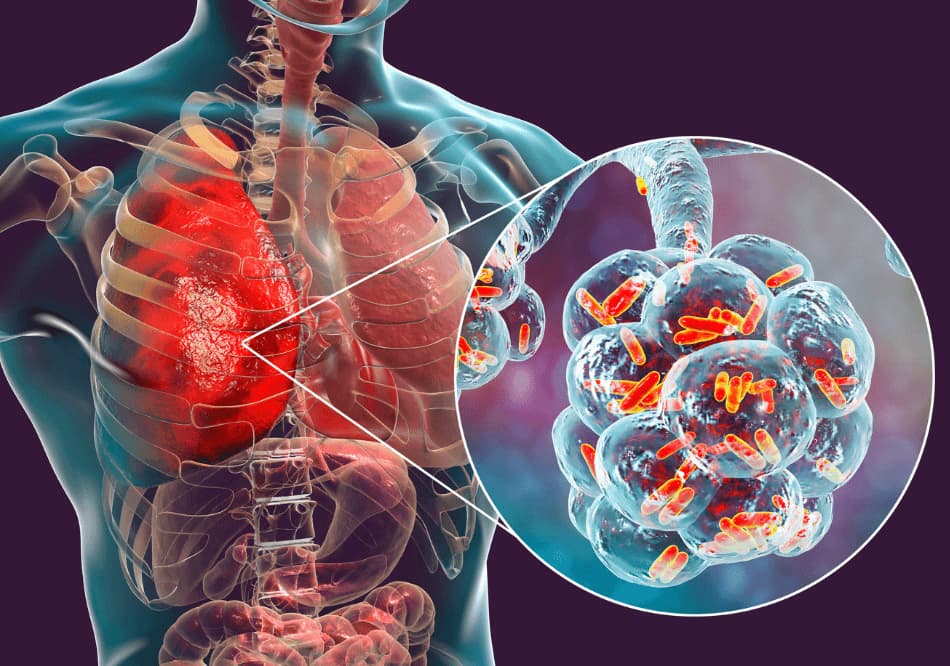 ayurvedic treatment for Lung Disease arogyavedh ayurveda Near Baner Balewadi