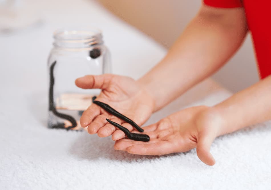 leech therapy in Ayurveda