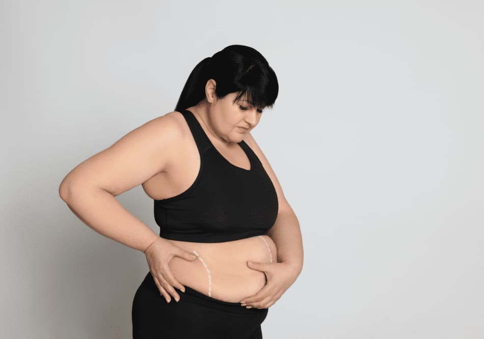obesity treatment in ayurveda | Arogyavedh Ayurveda | Dr. Banashree Patil Baner Balewadi